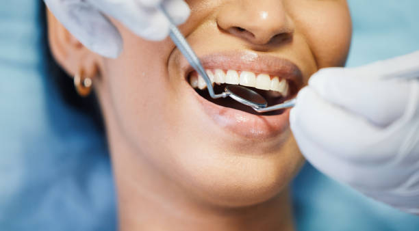Best After-Hours Dental Trauma Care in Port Sulphur, LA